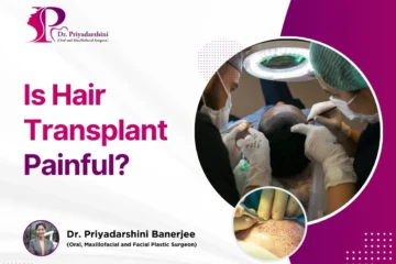 is hair transplant successfull