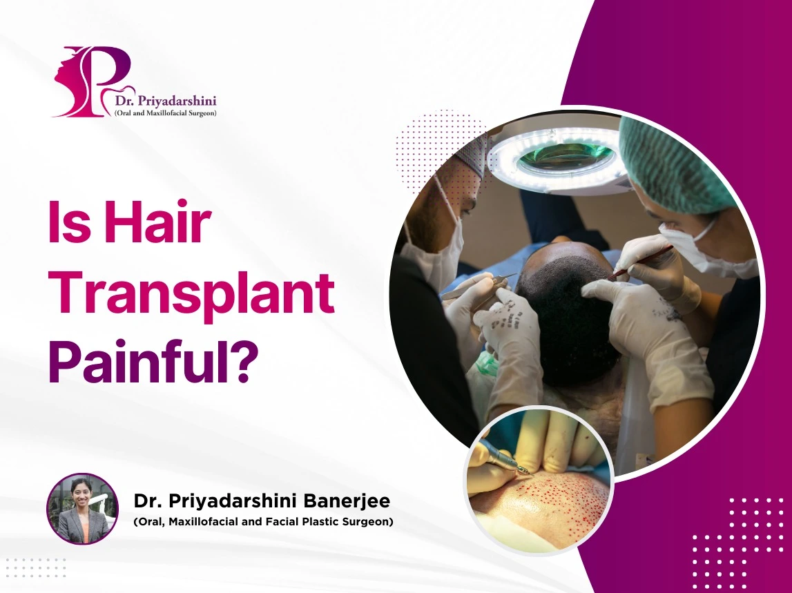 is hair transplant successfull