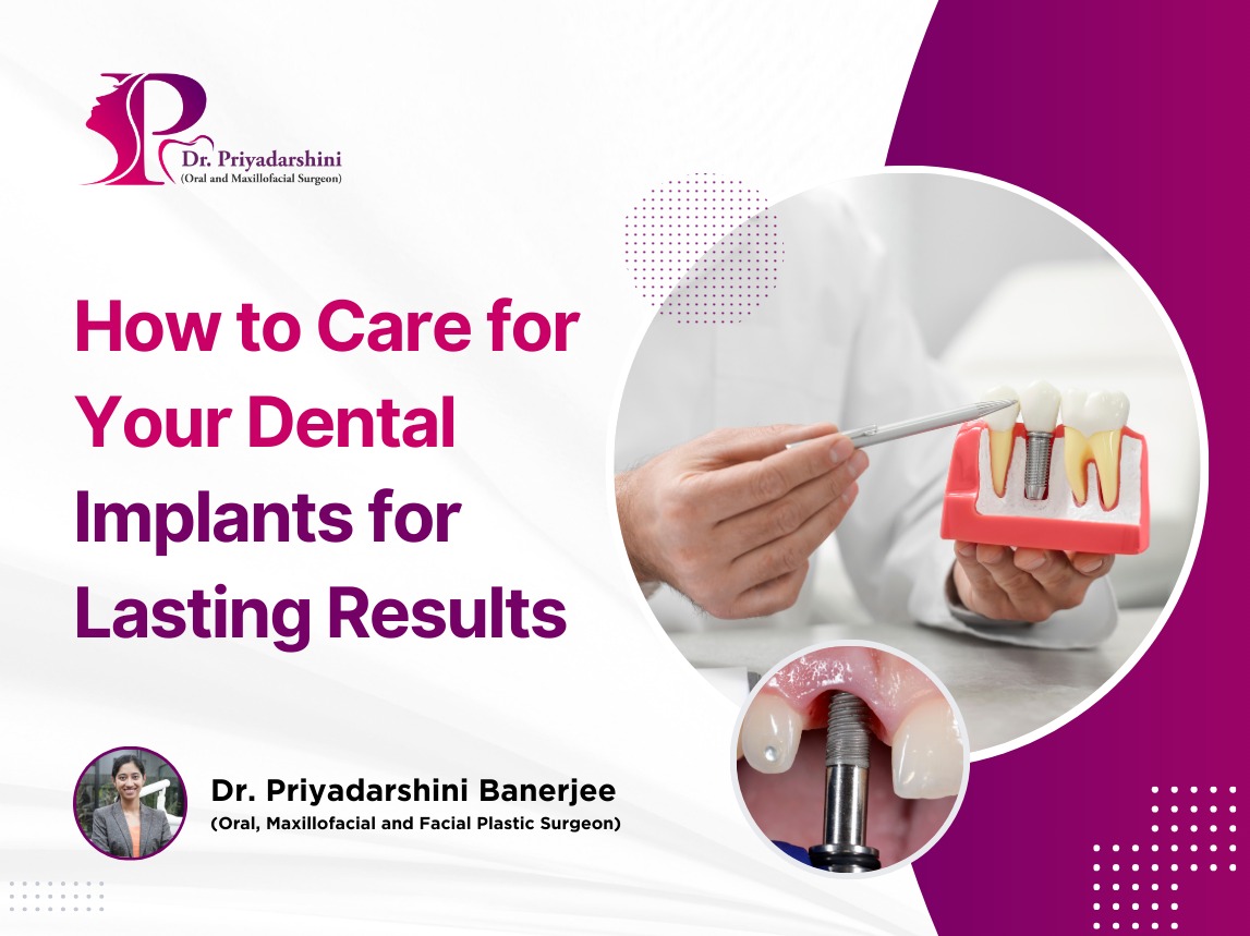 How to Care for Your Dental Implants for Lasting Results