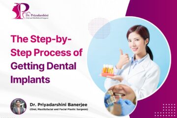 The Step-by-Step Process of Getting Dental Implants