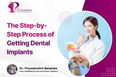 The Step-by-Step Process of Getting Dental Implants