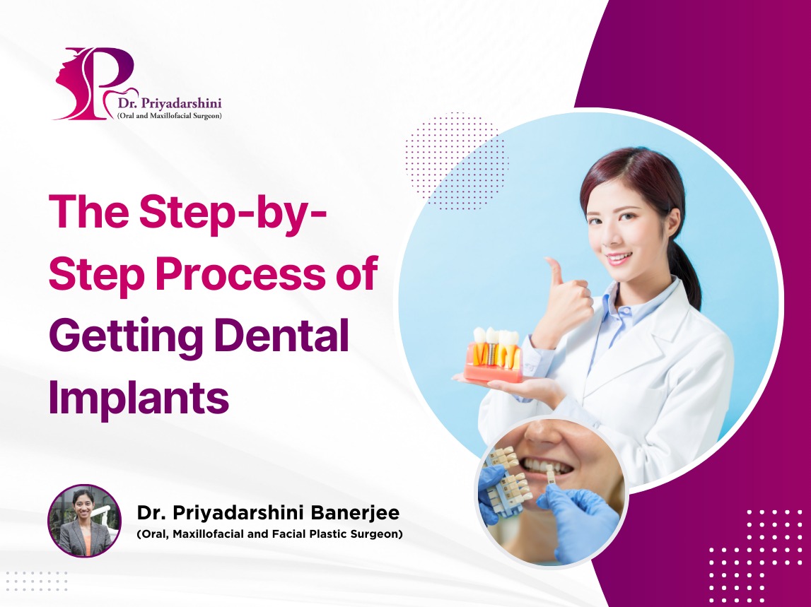 The Step-by-Step Process of Getting Dental Implants