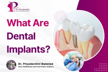 What Are Dental Implants? A Complete Guide