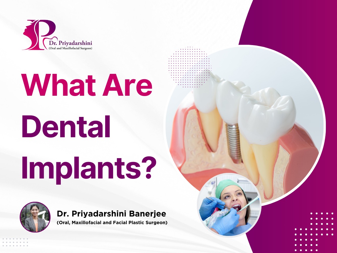 What Are Dental Implants? A Complete Guide