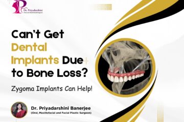 Can’t Get Dental Implants Due to Bone Loss