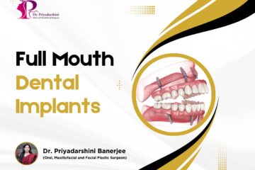 Full Mouth Dental Implants