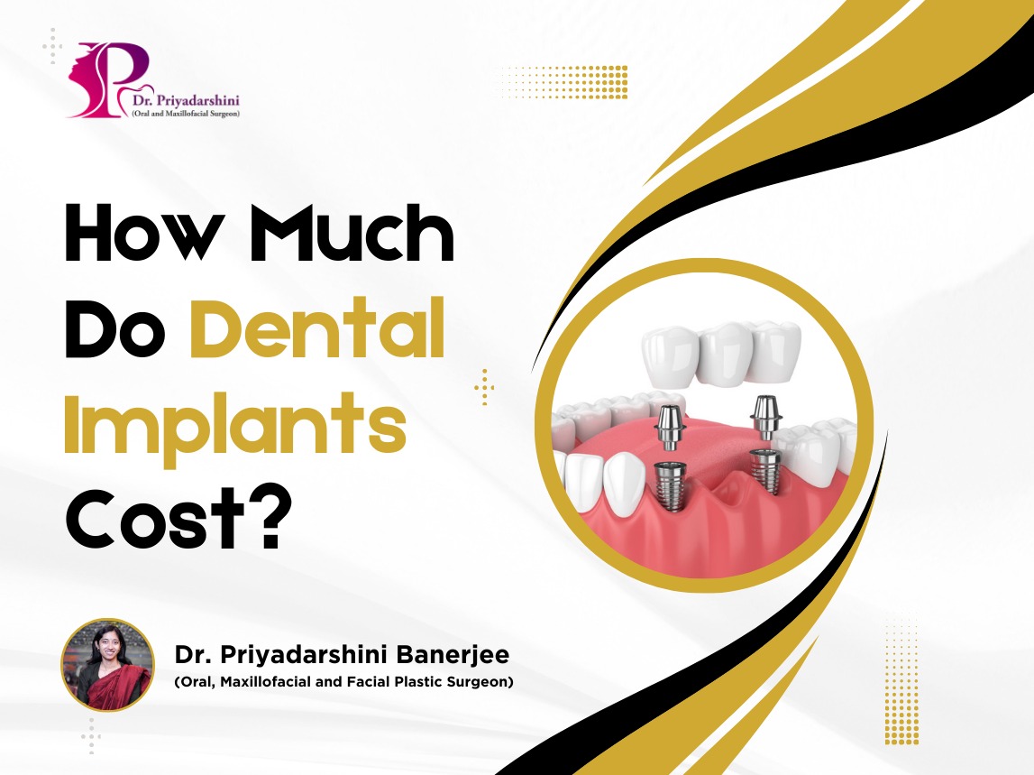 How Much Do Dental Implants Cost