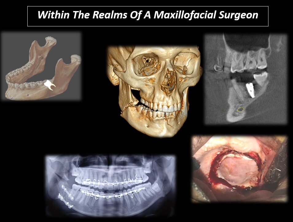 Scope of Oral Surgeon