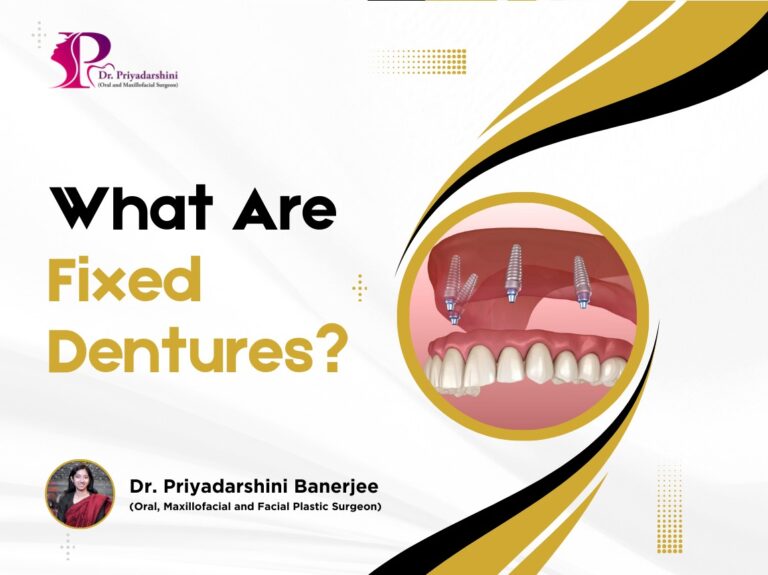 What Are Fixed Dentures