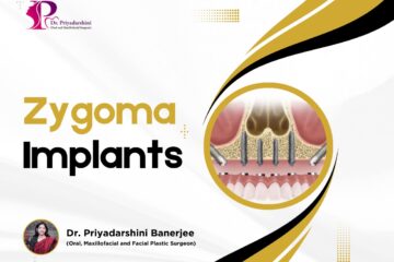 Zygoma Implants