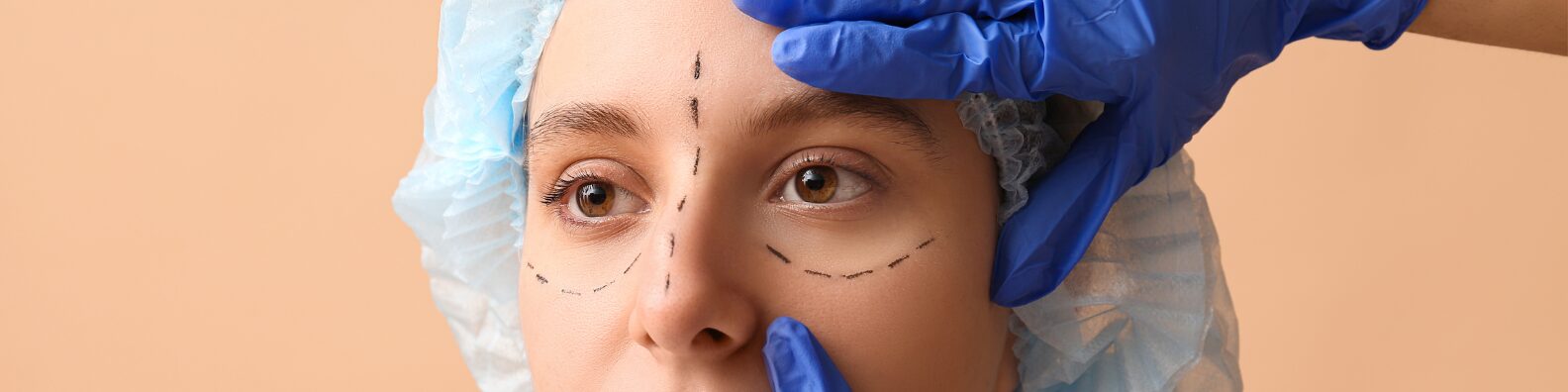 Blepharoplasty (Eyelid Surgery)