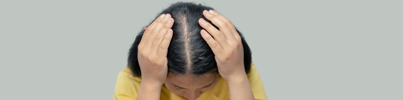 Female Hair Transplant