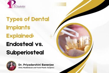 denatl implants types