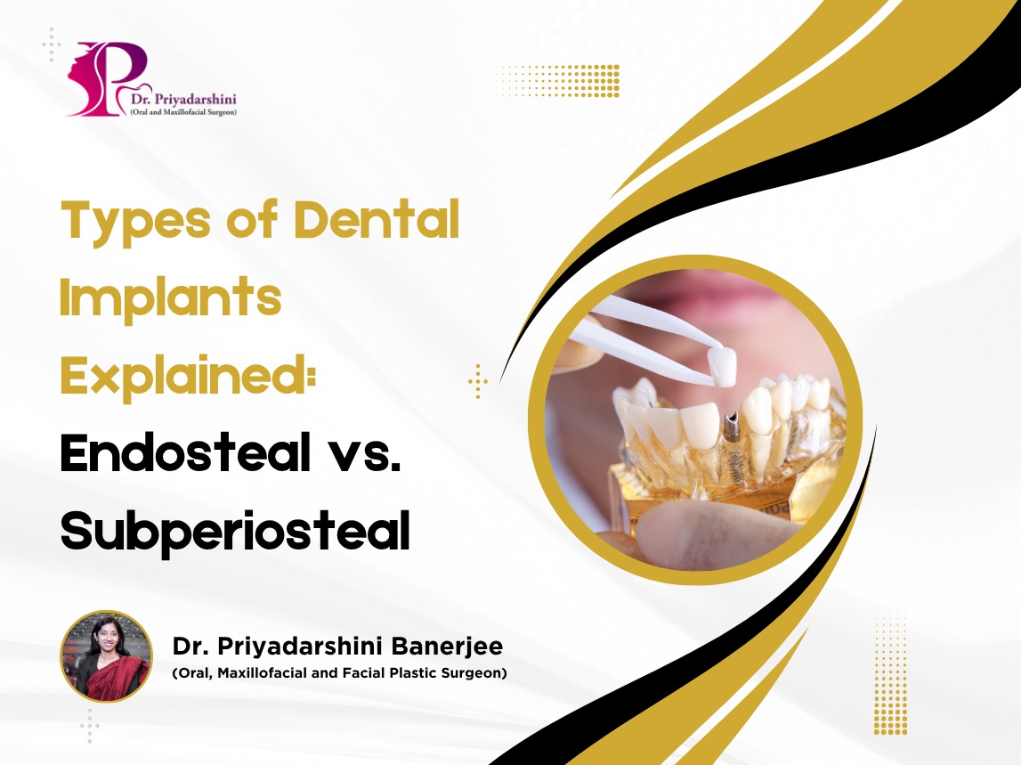 denatl implants types