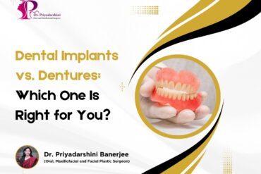 dental implant