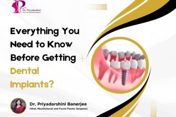 dental implant