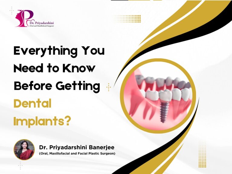 dental implant