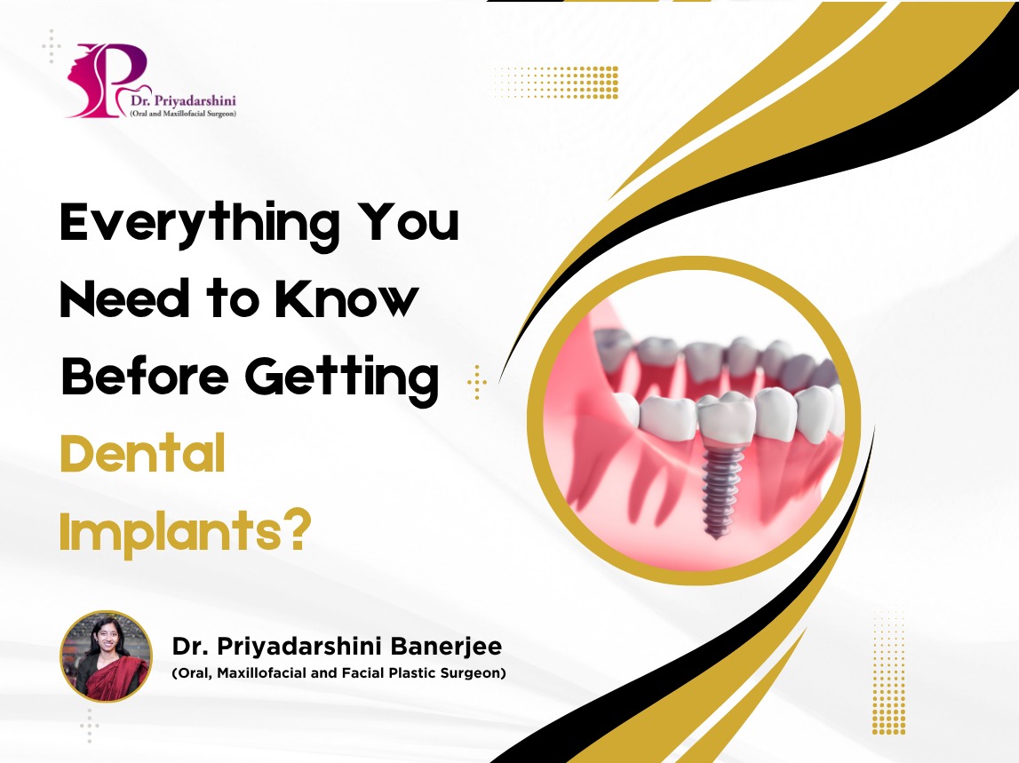 dental implant