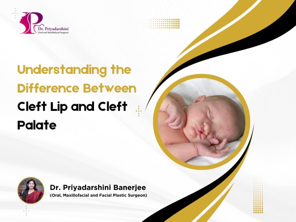 What Is Cleft Lip and Palate?
