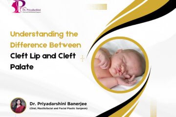 What Is Cleft Lip and Palate?