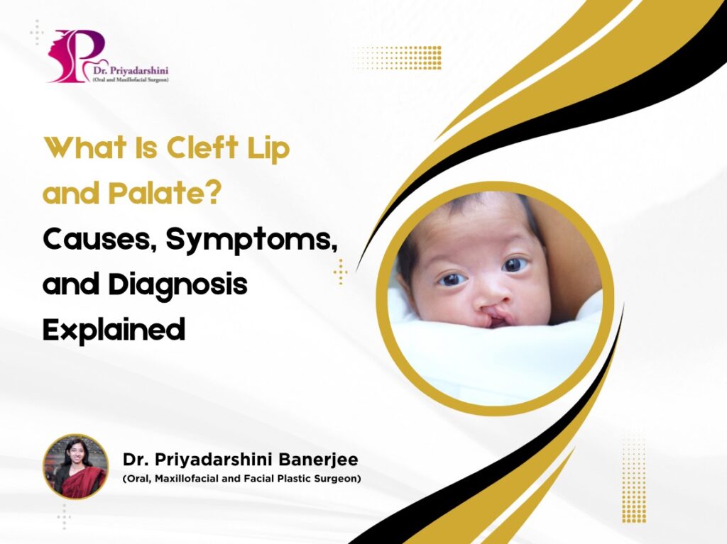 What Is Cleft Lip and Palate