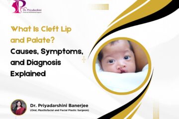 What Is Cleft Lip and Palate