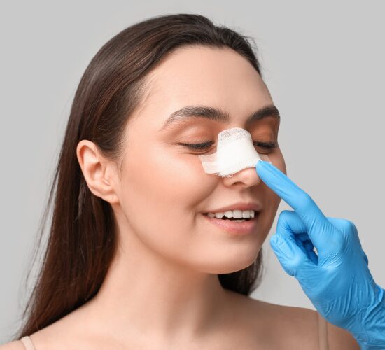 rhinoplasty